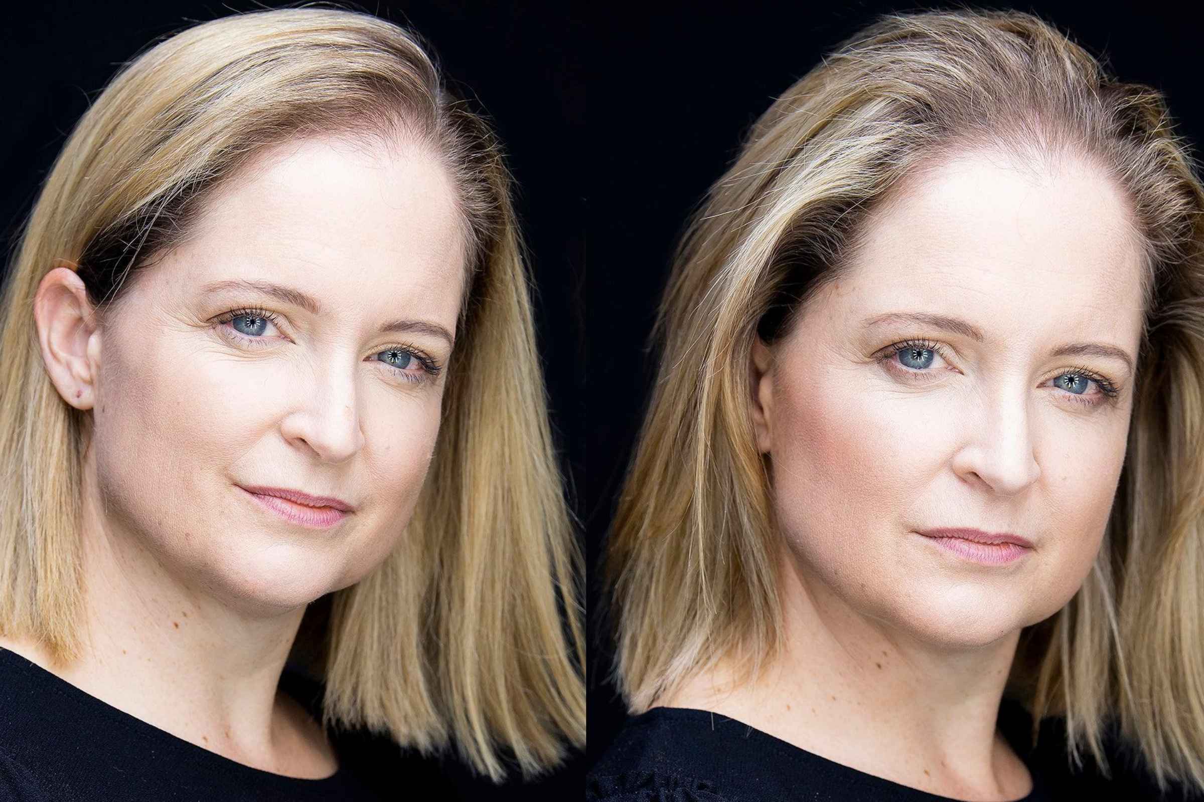 MyEasyGlow model before and after cool glow